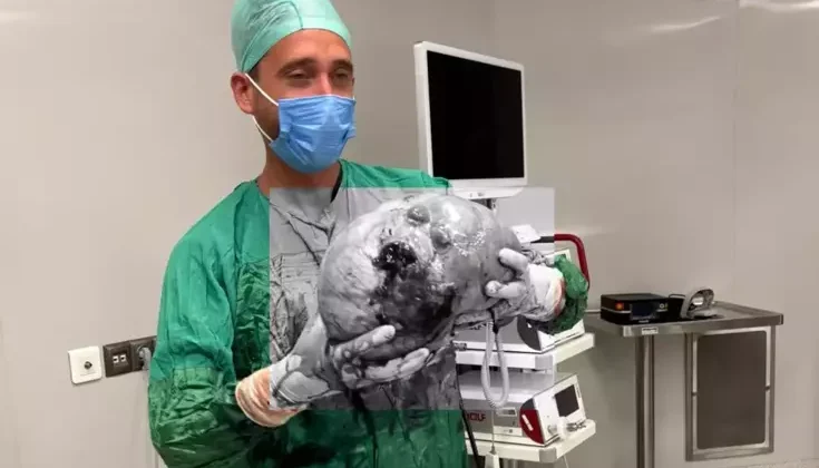 70 yaşındaki kadının karnından 40 kilogram kitle çıkarıldı